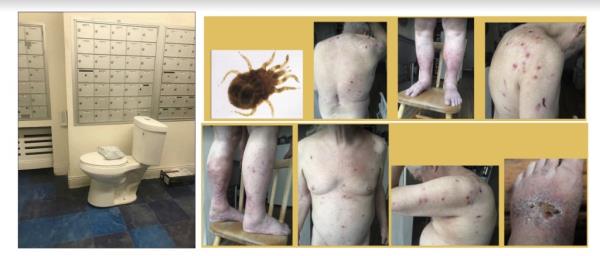 Photos of tenants allegedly impacted by bedbugs at the buildings.