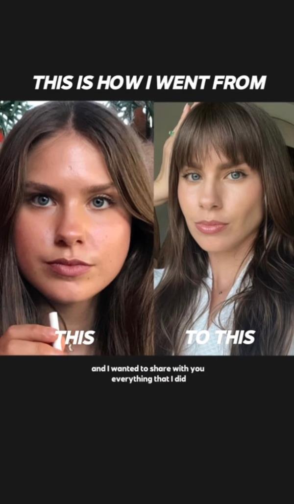 TikTok user Steph Flockhart discusses how she treated her "moon face"